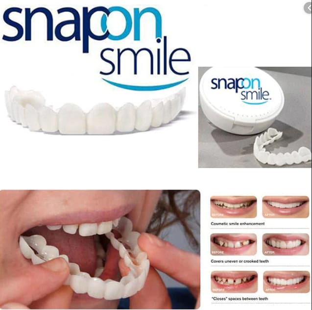 Silicone Imitation Braces Teeth Decoration Kits