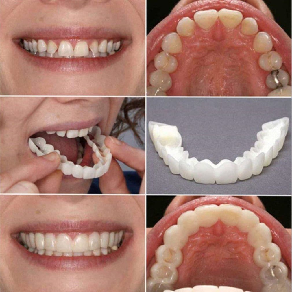 Silicone Imitation Braces Teeth Decoration Kits